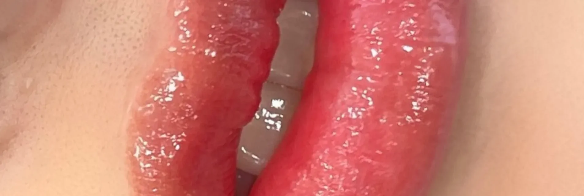 oral after lip blush