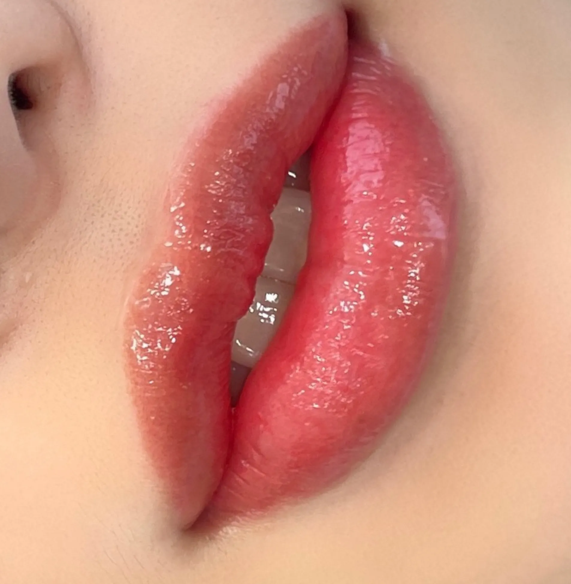 oral after lip blush